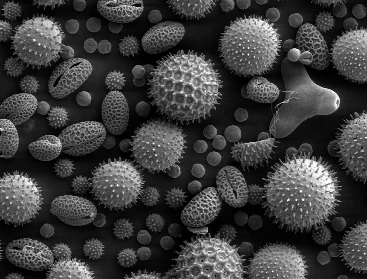 花粉の電子顕微鏡写真
